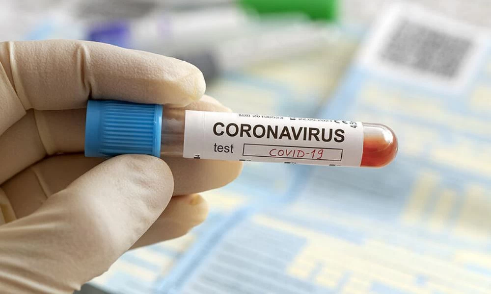Χιλή: Πάνω από 6.100 κρούσματα και 104 νεκροί το τελευταίο 24ωρο